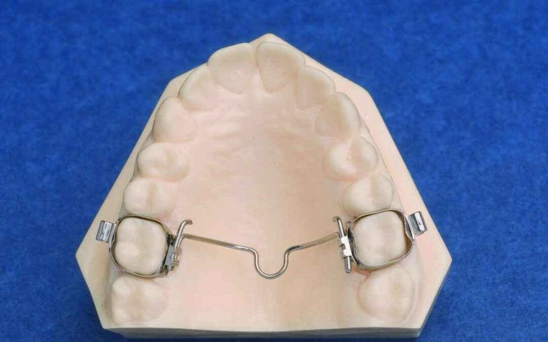 mantenedores de espacio