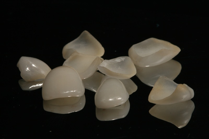 Carillas de Porcelana | Tratamientos Dentales | Implante Dental | Clínica Dental Larrañaga | Carillas estéticas