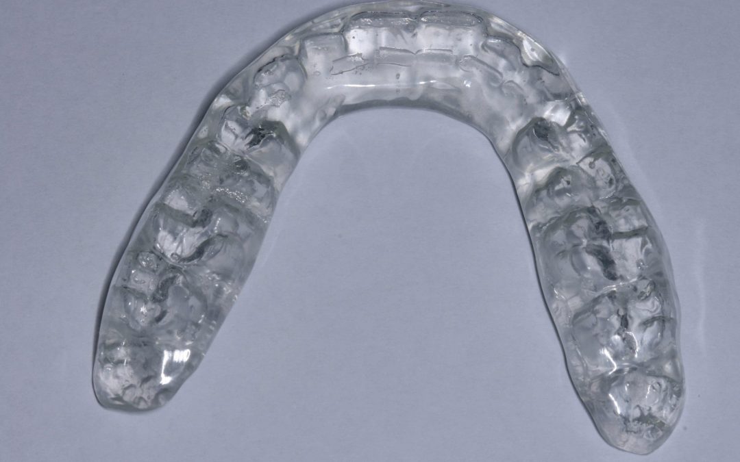 Férula de Descarga para el Bruxismo  Clínica Dental MiBO Almería 