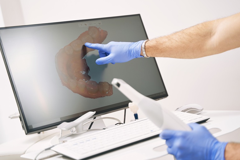 Dentista revisando las imágenes dentales |Escáner Intraotal | Tratamientos Dentales | Clínica Dental Madrid