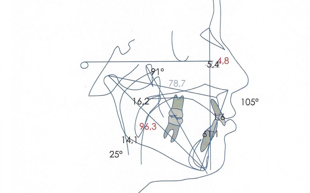 Diagnóstico en Ortodoncia