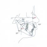 Diagnóstico en Ortodoncia