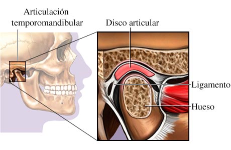 Dolor de la articulación temporomandibular