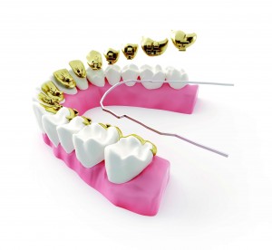 Ortodoncia lingual | Dentista | Endodoncia | Implantes dentales