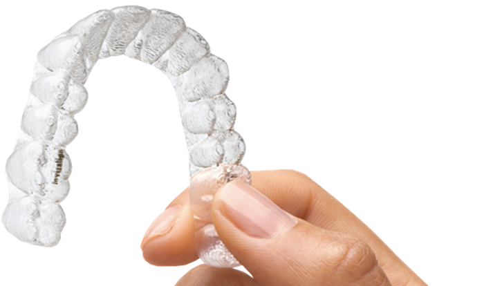 mantenimiento de la ortodoncia invisible