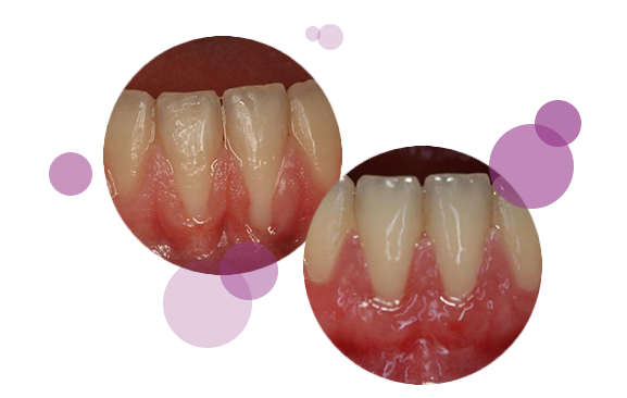 caso-periodoncia-1