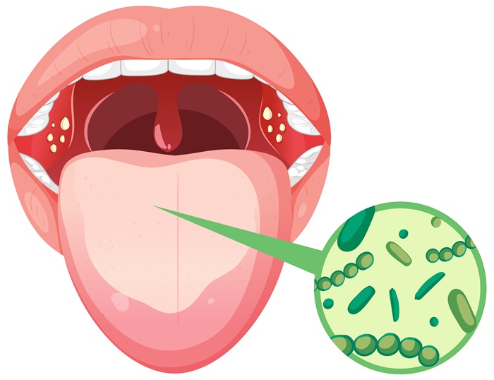 Dibujo boca con bacterias | Mal Aliento | Salud Bucodental | Clínica Dental en Madrid Río