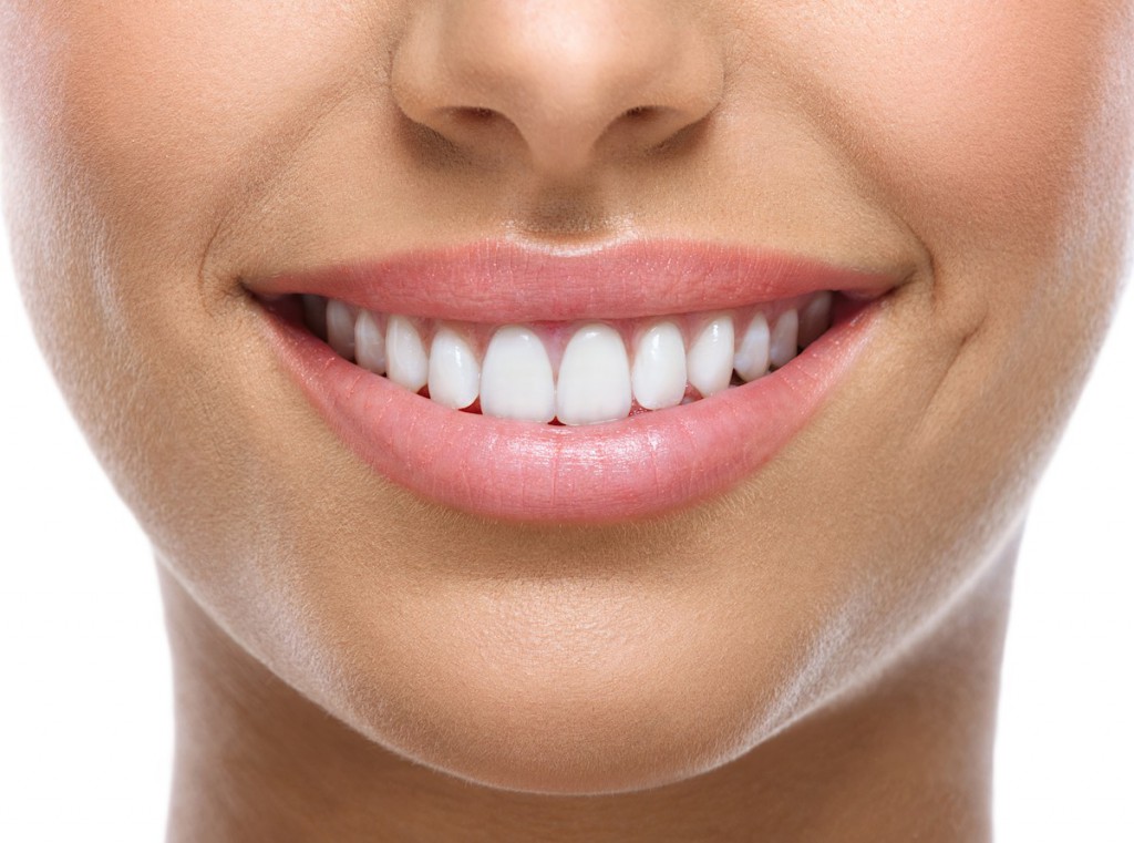 Imagen de mujer sonriendo | Carilla dental | Endodoncia dental | Implantes