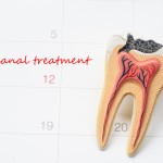 ¿Duele una endodoncia?