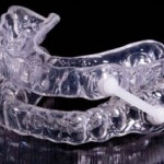 Apnea del sueño: cómo puede ayudarte tu dentista en Madrid