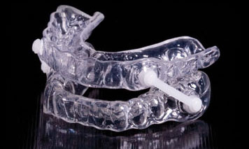 Apnea del sueño: cómo puede ayudarte tu dentista en Madrid