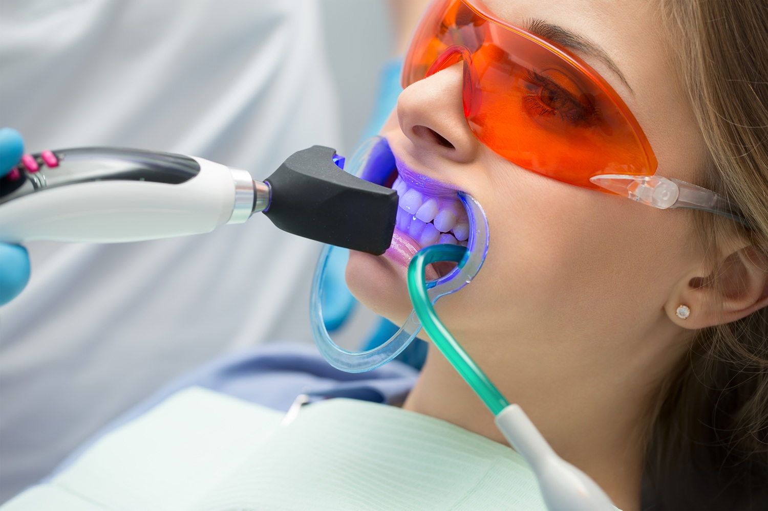 Mujer realizando tratamiento dental | blanqueamiento dental | Estética dental | Clinica dental Madrid | Clinica dental Larrañaga