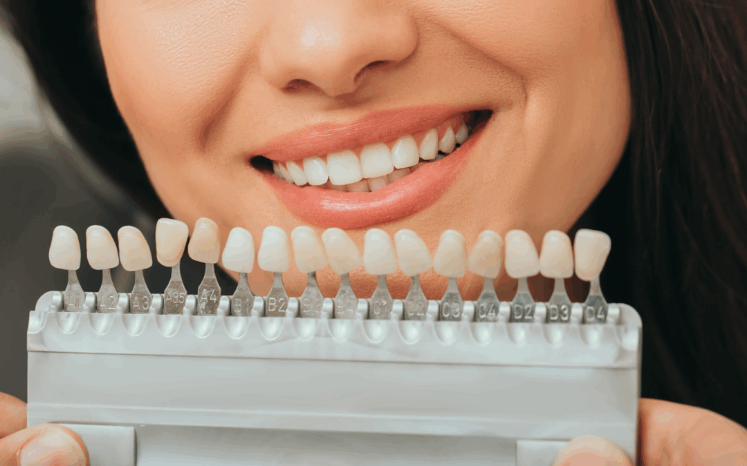 Sonríe al buen tiempo: descubre los beneficios del blanqueamiento dental