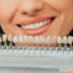 Sonríe al buen tiempo: descubre los beneficios del blanqueamiento dental