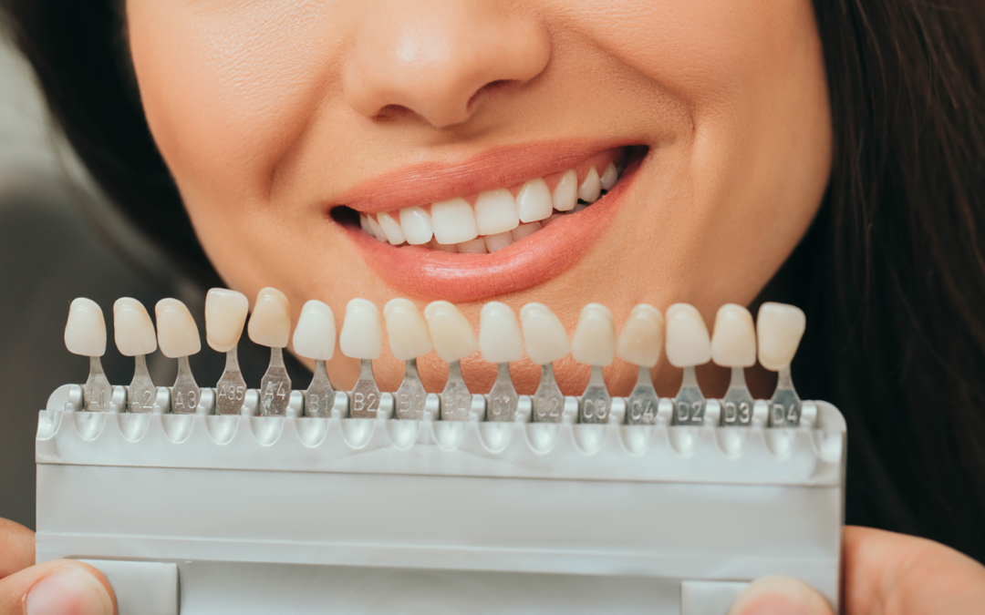 paleta de esmaltado dental