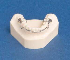 Mantenedores de espacio dental | Dentista Legazpi | Clínica dental infantil | Mejores implantes dentales