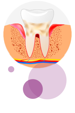 periodoncia
