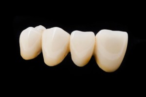 Prótesis dental fija | Clínica dental Larrañaga | Mejores implantes dentales | Dentista implantes
