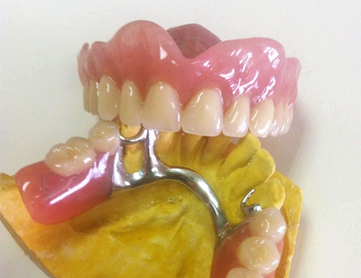 Dentadura Postiza Removible Económicas Temporales de Dientes Postizos