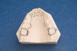 Mantenedores de espacio dental | Dentista Legazpi | Clínica dental infantil | Mejores implantes dentales