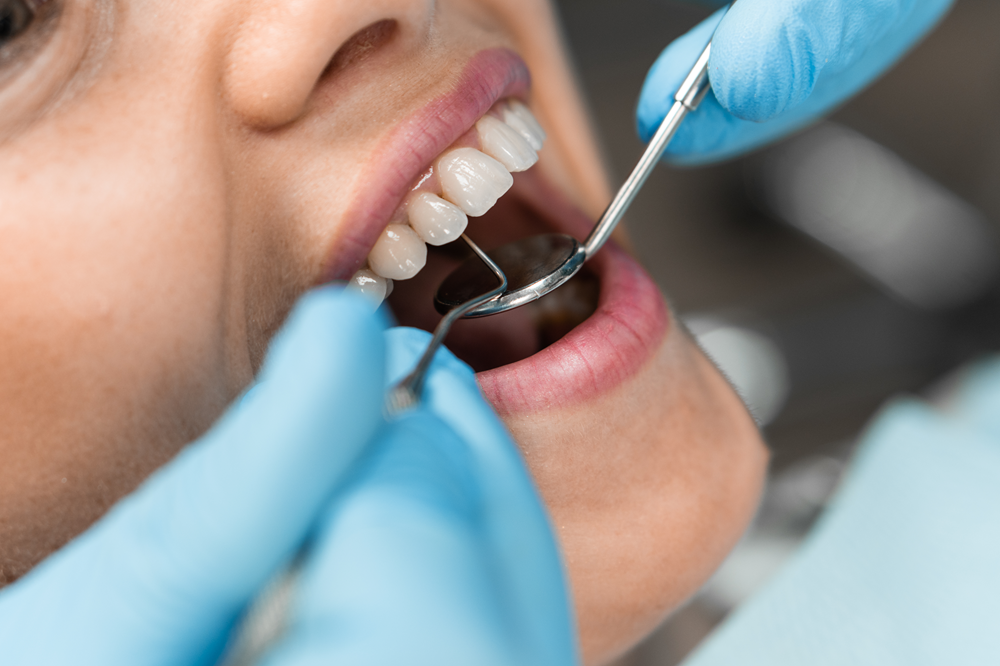 Imagen de paciente con la boca abierta mientras el dentista realiza la revisión dental | Limpieza Dental Después de las Vacaciones | Dentista Madrid Río | Clinica Dental Larrañaga
