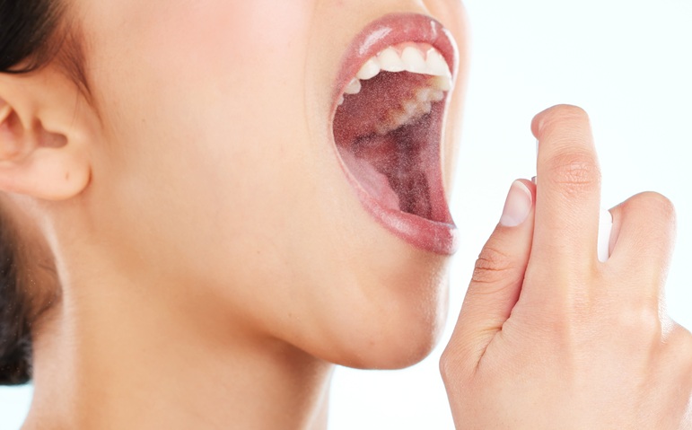 Mal aliento: causas frecuentes y cómo mejorar la salud bucodental